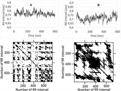 Recurrence Quantification Analysis of Heart Rate During Mental Arithmetic Stress in Young Females